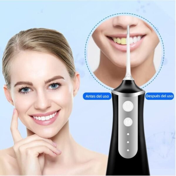 Irrigador Bucal Portatil,Hilo Dental de Agua Recargable,con 5 Puntas y 3 Modos,300ml,Water Flosser Portable Electrico,Limpieza Dental Portatil Oral Inalámbrico,Limpiador de Dientes para Hogar y Viajes